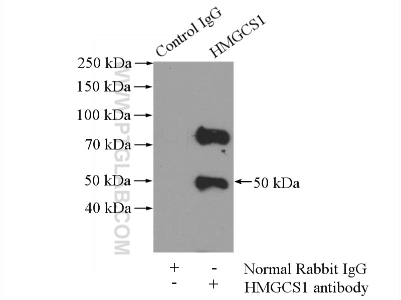 Immunoprecipitation (IP) experiment of mouse liver tissue using HMGCS1 Polyclonal antibody (17643-1-AP)