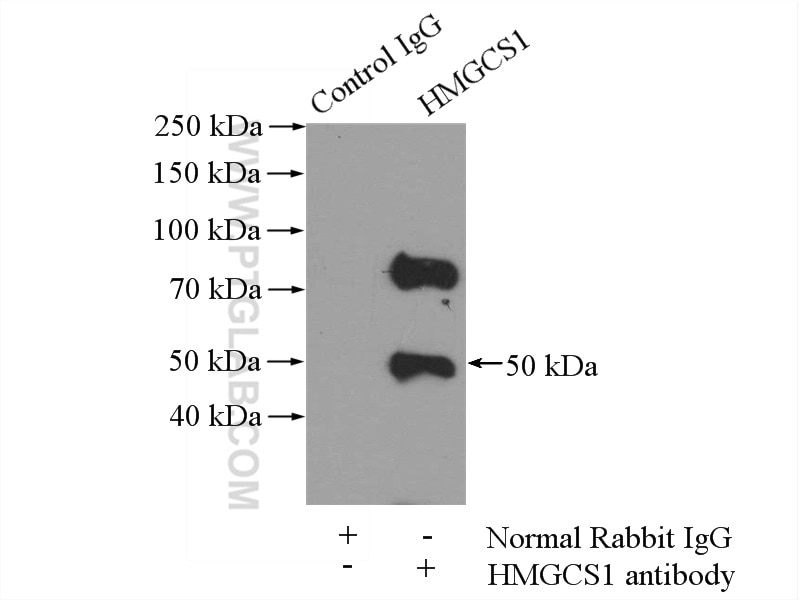 IP experiment of mouse liver using 17643-1-AP