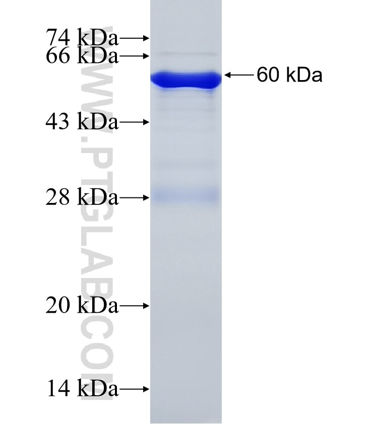 HMGCS1 fusion protein Ag11825 SDS-PAGE
