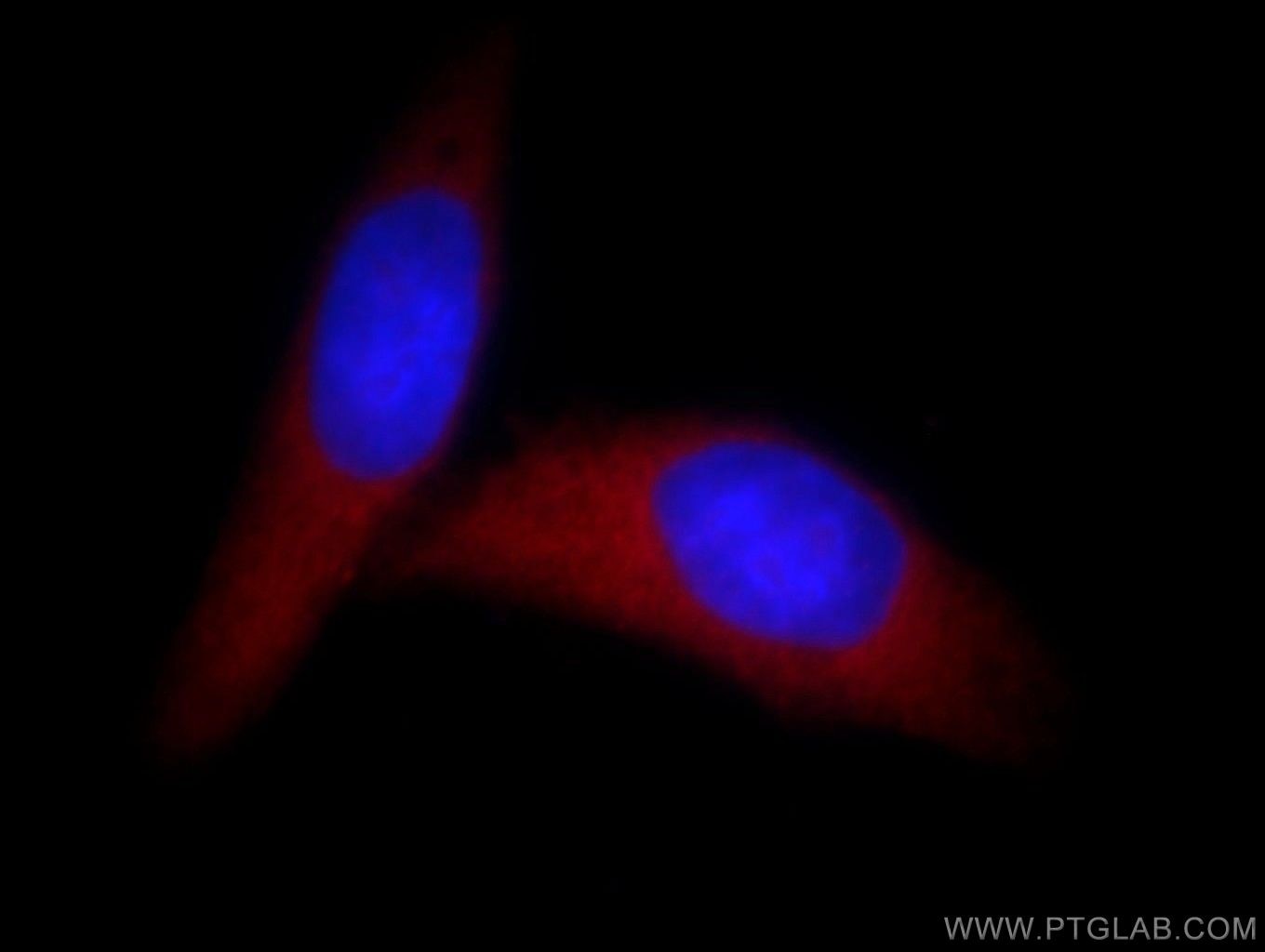 Immunofluorescence (IF) / fluorescent staining of HepG2 cells using HMGN1 Polyclonal antibody (11695-1-AP)
