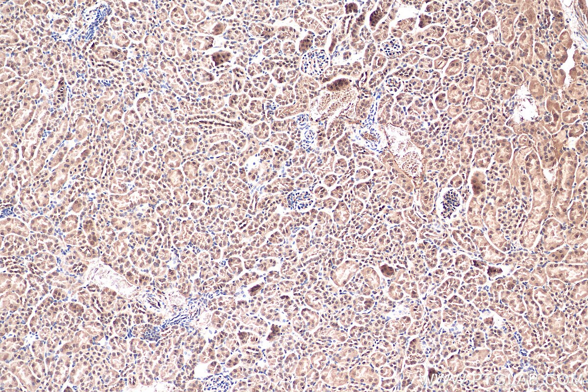 Immunohistochemistry (IHC) staining of mouse kidney tissue using HMGN1 Polyclonal antibody (11695-1-AP)