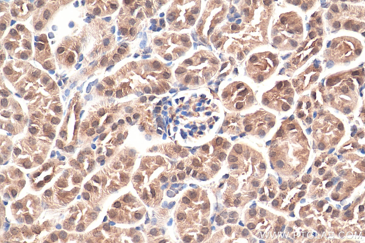 Immunohistochemistry (IHC) staining of mouse kidney tissue using HMGN1 Polyclonal antibody (11695-1-AP)
