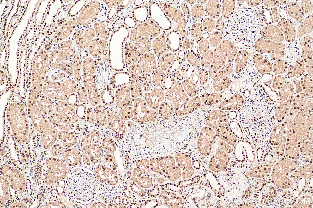 Immunohistochemistry (IHC) staining of human kidney tissue using HMGN1 Polyclonal antibody (11695-1-AP)