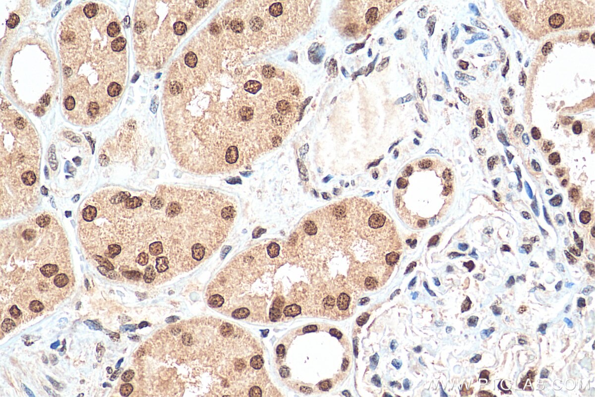 Immunohistochemistry (IHC) staining of human kidney tissue using HMGN1 Polyclonal antibody (11695-1-AP)