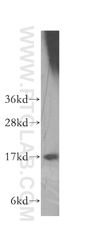 Western Blot (WB) analysis of HeLa cells using HMGN1 Polyclonal antibody (11695-1-AP)