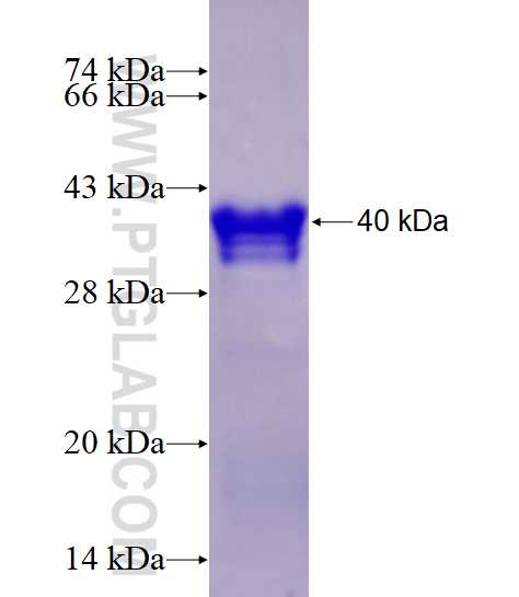HMGN1 fusion protein Ag2315 SDS-PAGE