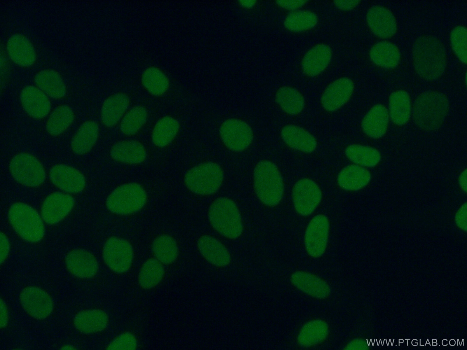 Immunofluorescence (IF) / fluorescent staining of HepG2 cells using HMGN2 Polyclonal antibody (10953-1-AP)