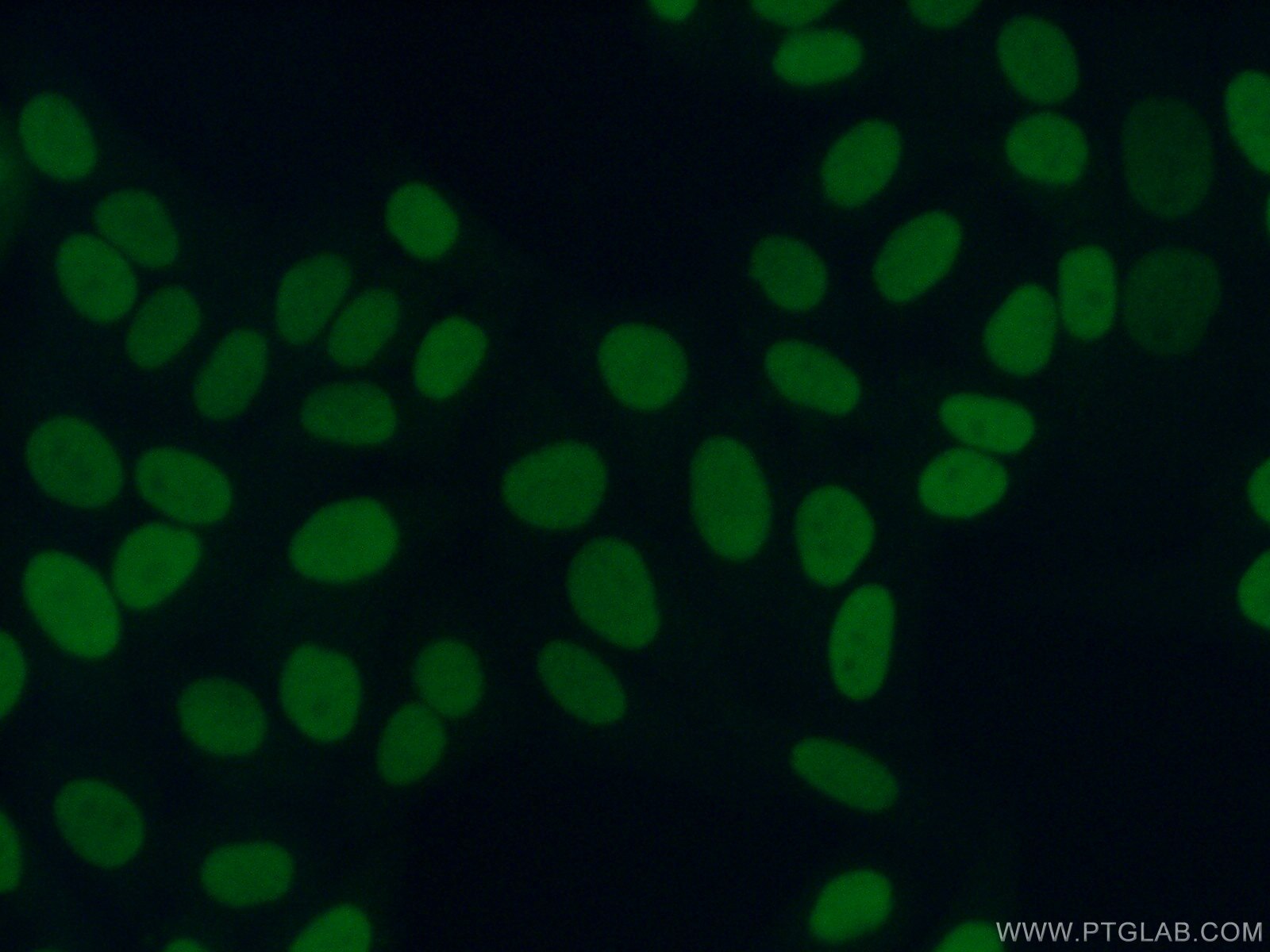 IF Staining of HepG2 using 10953-1-AP