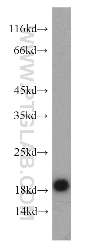 Western Blot (WB) analysis of Jurkat cells using HMGN2 Polyclonal antibody (10953-1-AP)