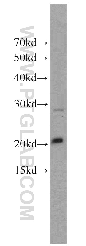Western Blot (WB) analysis of K-562 cells using HMGN2 Polyclonal antibody (10953-1-AP)