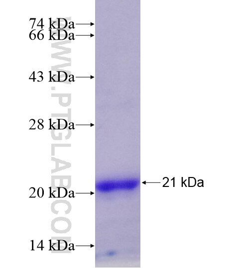 HMGN2 fusion protein Ag28531 SDS-PAGE HMGN2 fusion protein Ag28531 SDS-PAGE