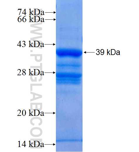 HMGN2 fusion protein Ag1401 SDS-PAGE