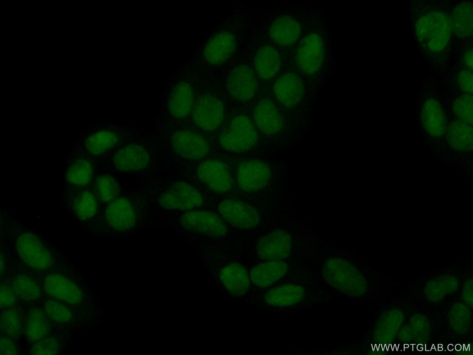 Immunofluorescence (IF) / fluorescent staining of HeLa cells using HMGN4 Polyclonal antibody (11686-1-AP)