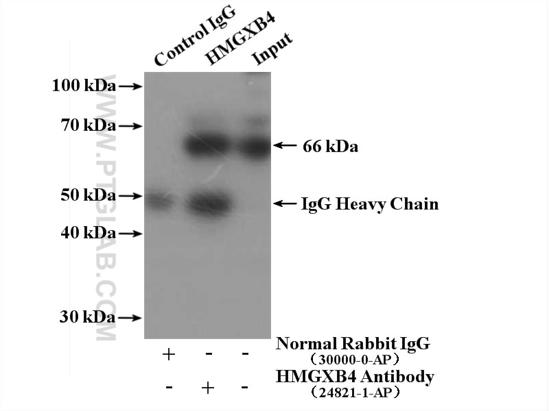Immunoprecipitation (IP) experiment of HeLa cells using HMGXB4 PolyClonal antibody (24821-1-AP)