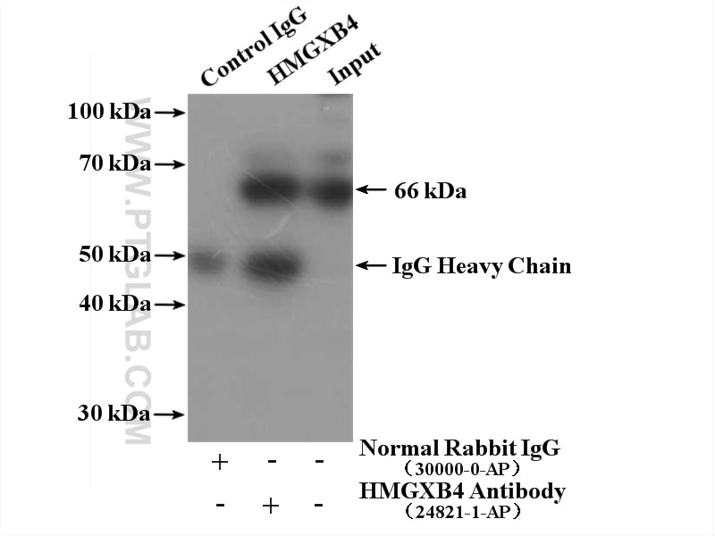 IP experiment of HeLa using 24821-1-AP