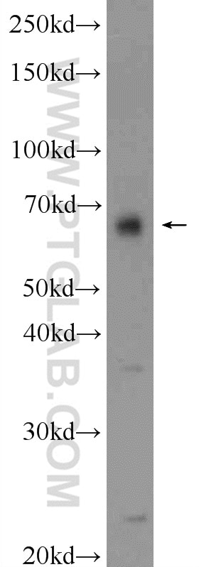 Western Blot (WB) analysis of HeLa cells using HMGXB4 PolyClonal antibody (24821-1-AP)