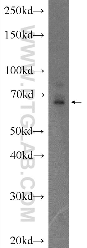 Western Blot (WB) analysis of Jurkat cells using HMGXB4 PolyClonal antibody (24821-1-AP)
