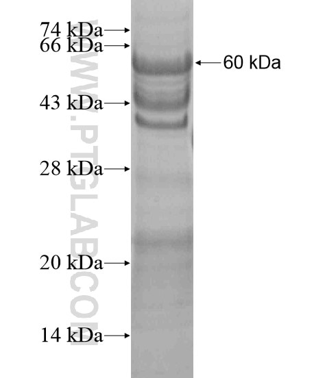 HMGXB4 fusion protein Ag20424 SDS-PAGE