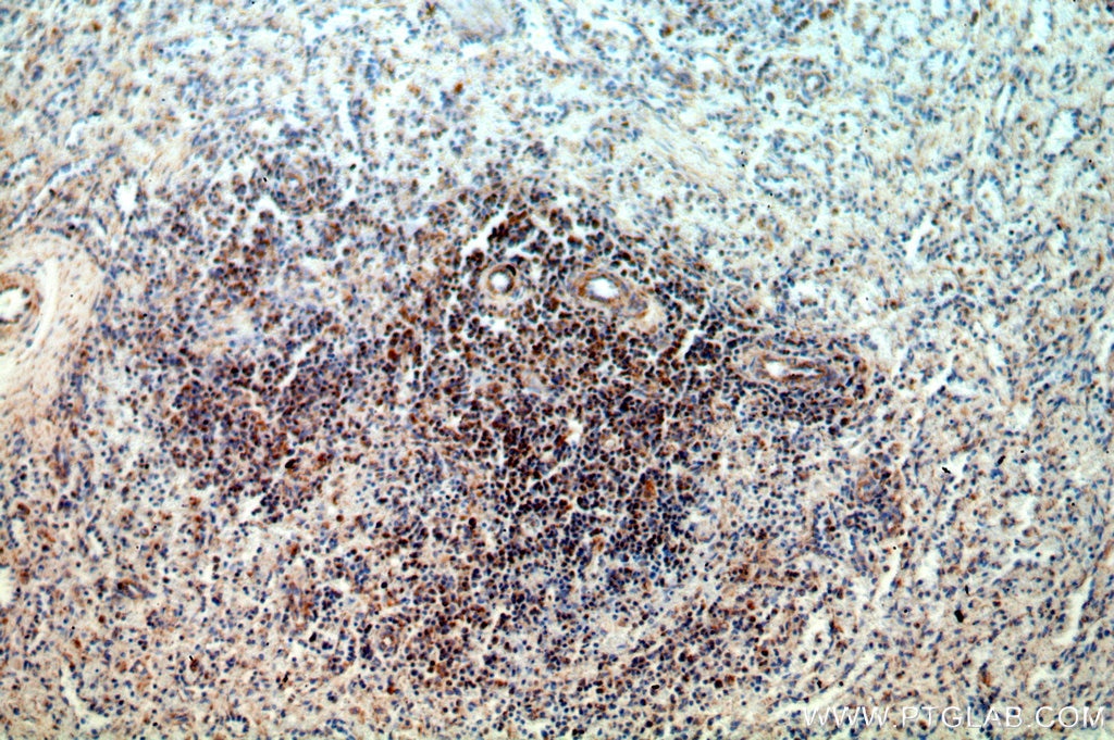 Immunohistochemistry (IHC) staining of human spleen tissue using HMHA1 Polyclonal antibody (14832-1-AP)