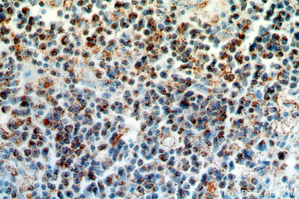 Immunohistochemistry (IHC) staining of human spleen tissue using HMHA1 Polyclonal antibody (14832-1-AP)
