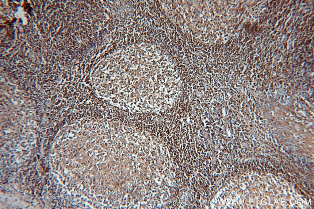 Immunohistochemistry (IHC) staining of human tonsil tissue using HMHA1 Polyclonal antibody (14832-1-AP)