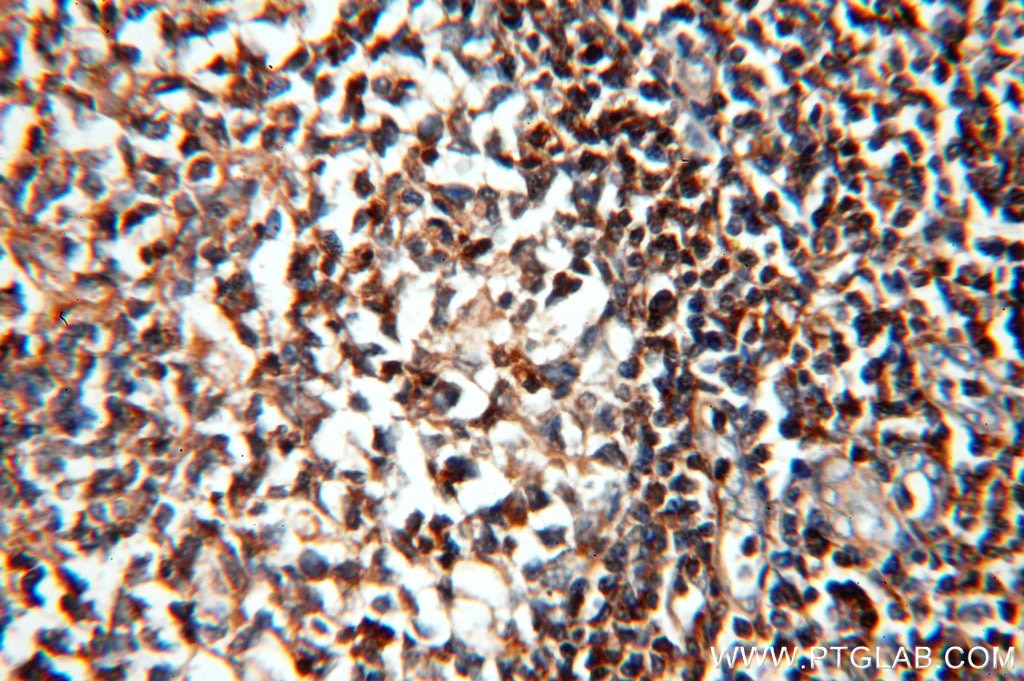 Immunohistochemistry (IHC) staining of human tonsil tissue using HMHA1 Polyclonal antibody (14832-1-AP)