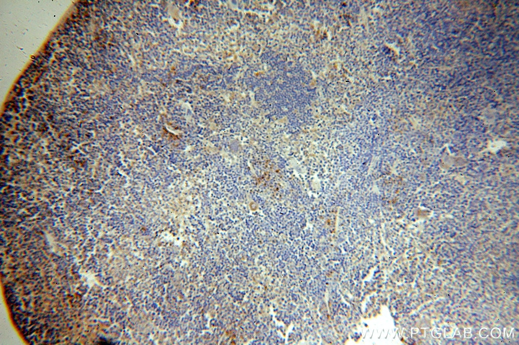 Immunohistochemistry (IHC) staining of mouse spleen tissue using HMHA1 Polyclonal antibody (14832-1-AP)