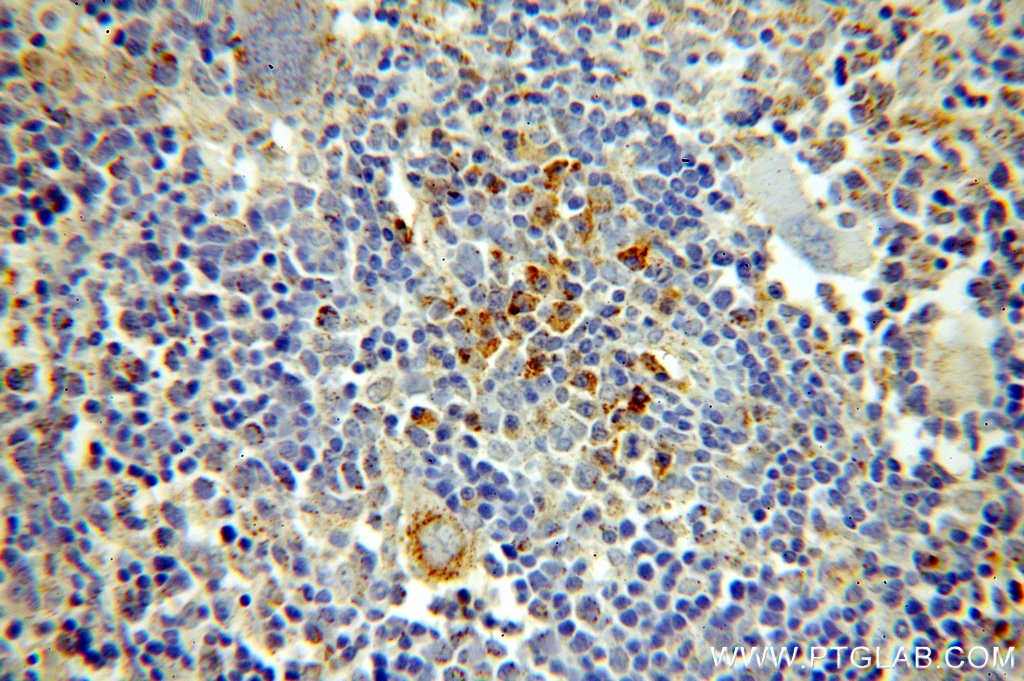 Immunohistochemistry (IHC) staining of mouse spleen tissue using HMHA1 Polyclonal antibody (14832-1-AP)