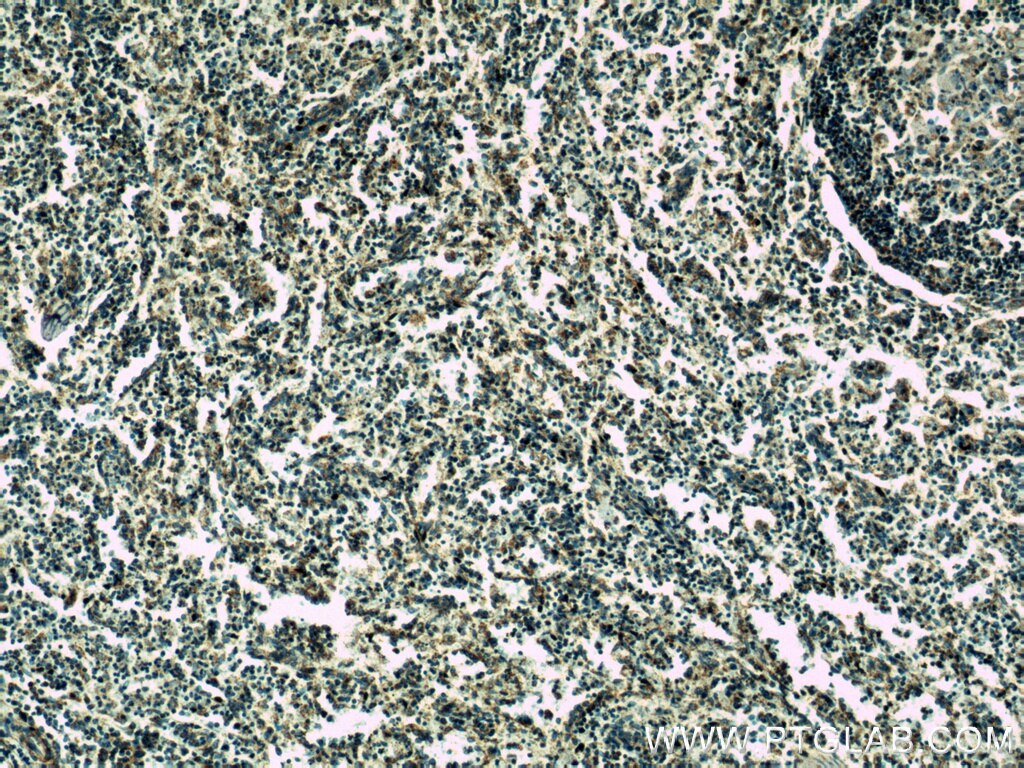 Immunohistochemistry (IHC) staining of human spleen tissue using HMHA1 Polyclonal antibody (14832-1-AP)