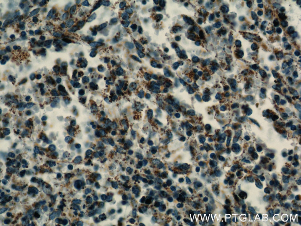 Immunohistochemistry (IHC) staining of human spleen tissue using HMHA1 Polyclonal antibody (14832-1-AP)