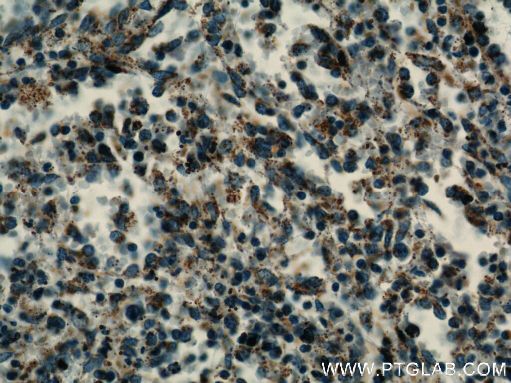 IHC staining of human spleen using 14832-1-AP