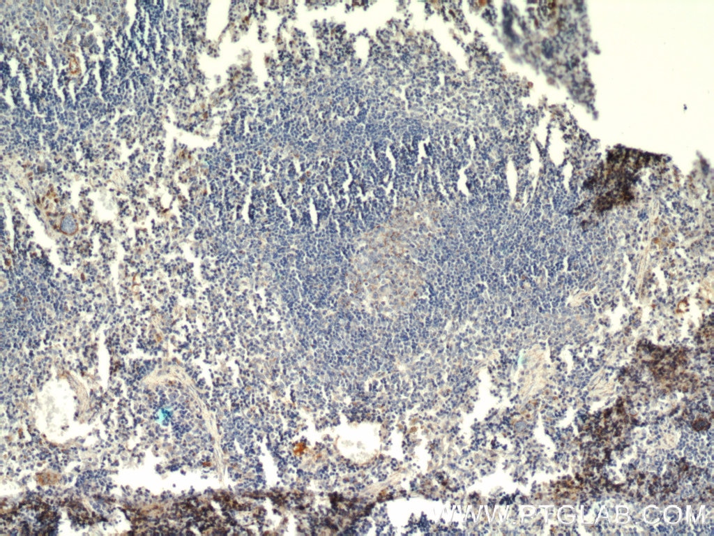 IHC staining of mouse spleen using 14832-1-AP