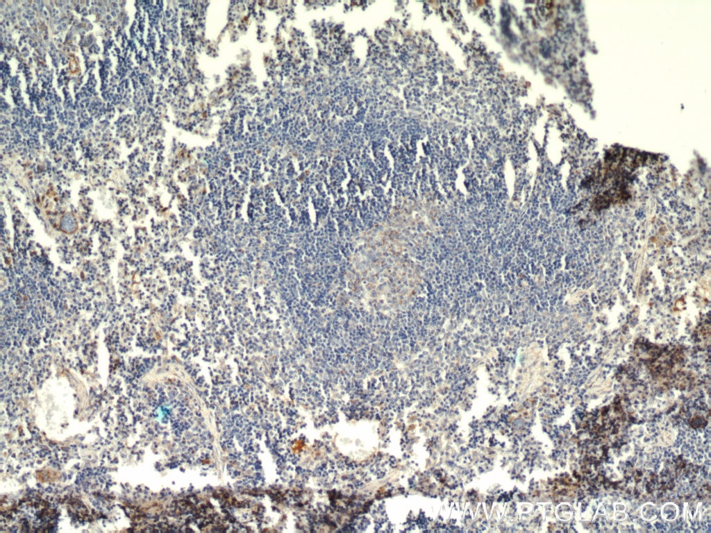 Immunohistochemistry (IHC) staining of mouse spleen tissue using HMHA1 Polyclonal antibody (14832-1-AP)