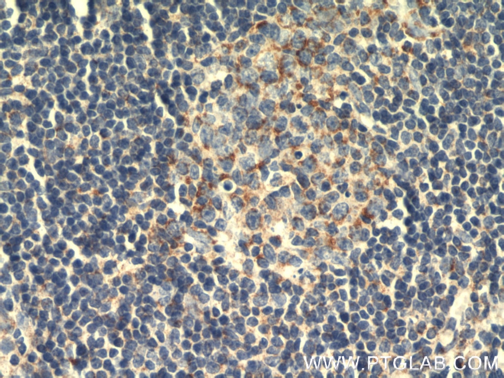 Immunohistochemistry (IHC) staining of mouse spleen tissue using HMHA1 Polyclonal antibody (14832-1-AP)
