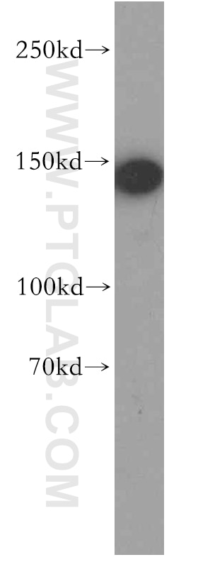 Western Blot (WB) analysis of K-562 cells using HMHA1 Polyclonal antibody (14832-1-AP)