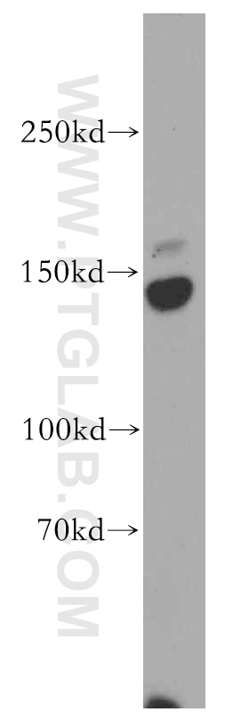 Western Blot (WB) analysis of A375 cells using HMHA1 Polyclonal antibody (14832-1-AP)