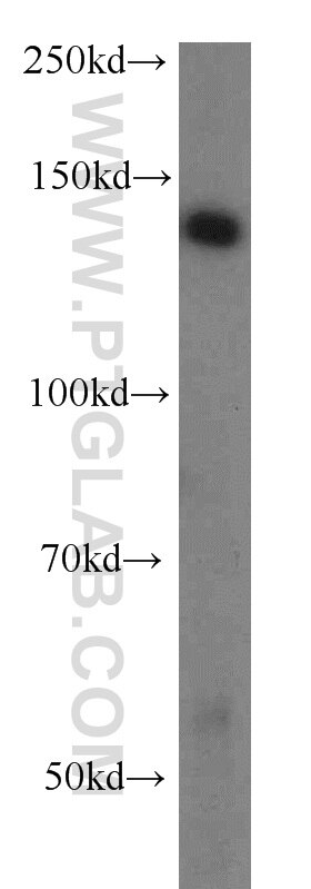 Western Blot (WB) analysis of mouse thymus tissue using HMHA1 Polyclonal antibody (14832-1-AP)