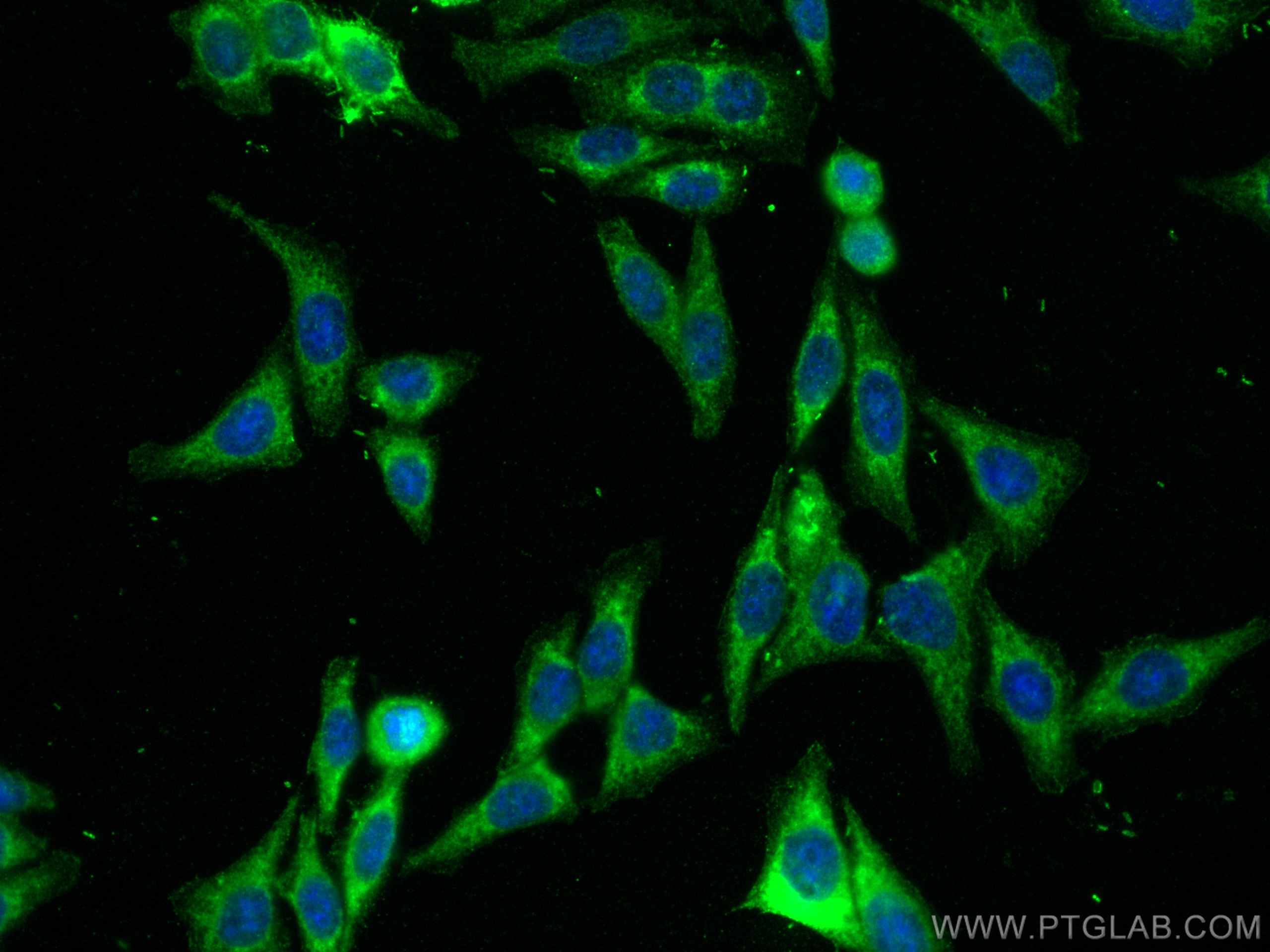 Immunofluorescence (IF) / fluorescent staining of HepG2 cells using HMMR-Specific Polyclonal antibody (15820-1-AP)