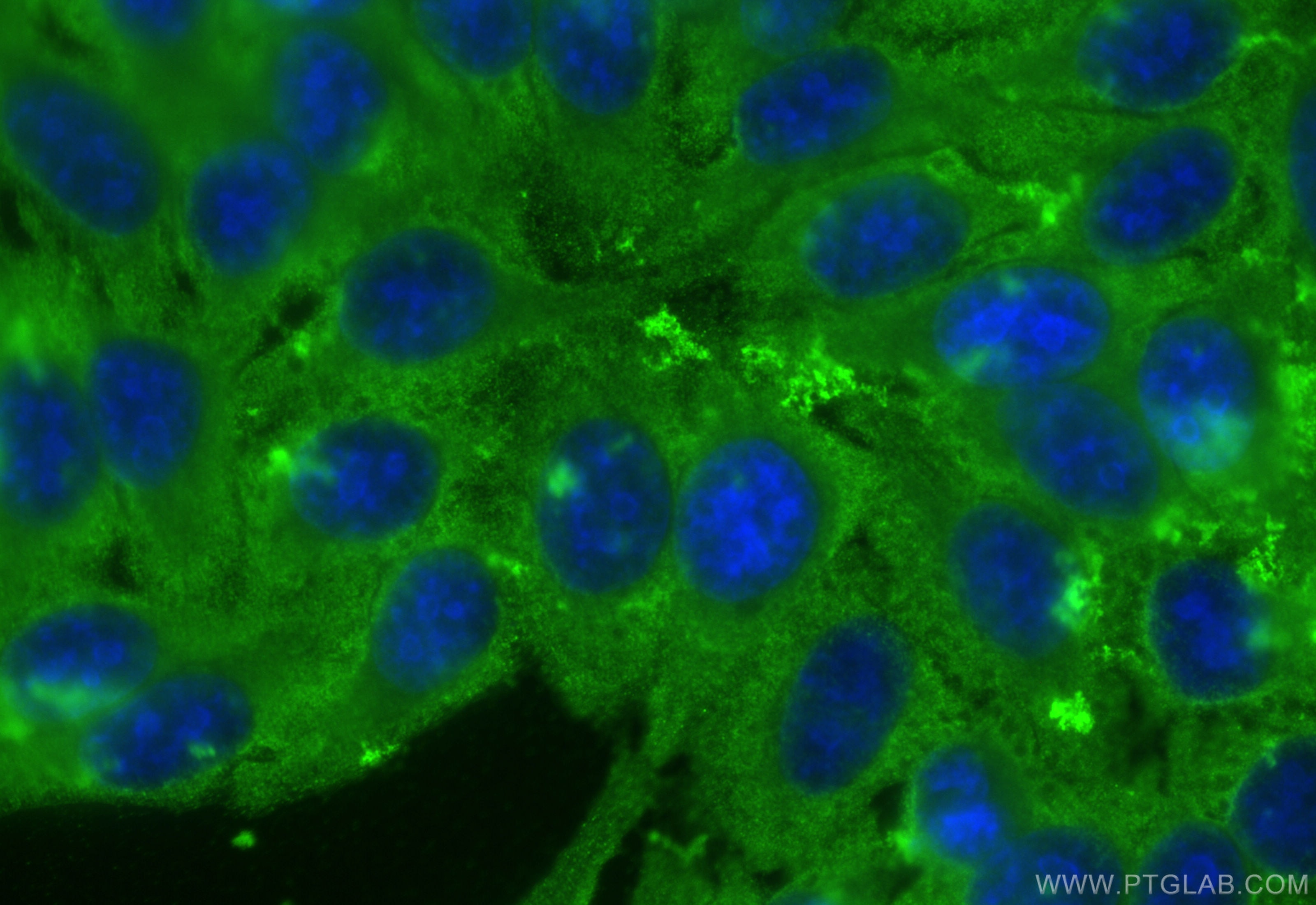 Immunofluorescence (IF) / fluorescent staining of HepG2 cells using HMMR-Specific Recombinant antibody (85094-1-RR)