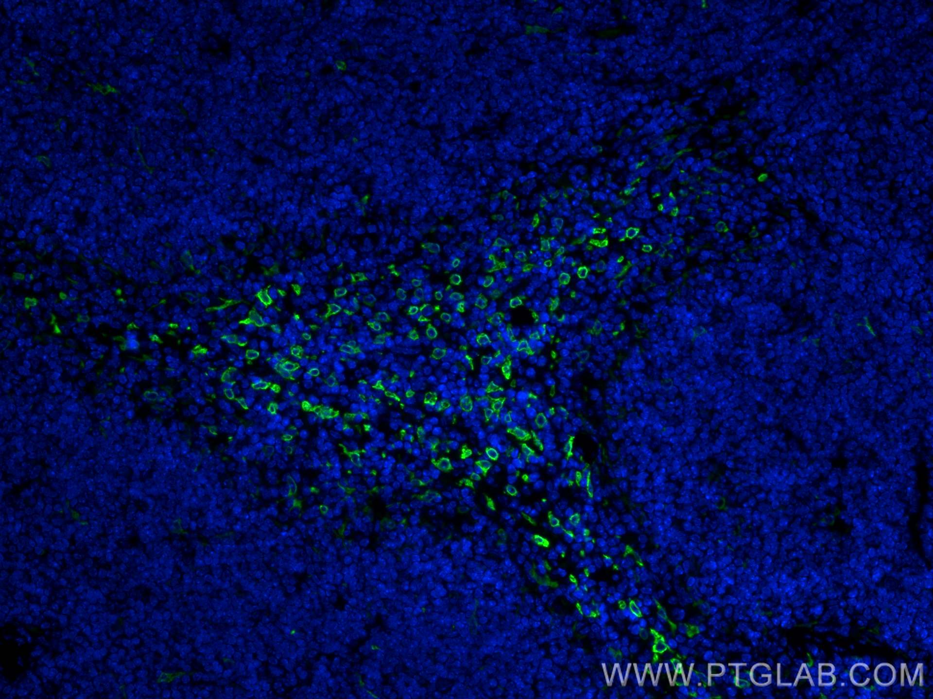 Immunofluorescence (IF) / fluorescent staining of mouse spleen tissue using HO-1/HMOX1 Polyclonal antibody (10701-1-AP)