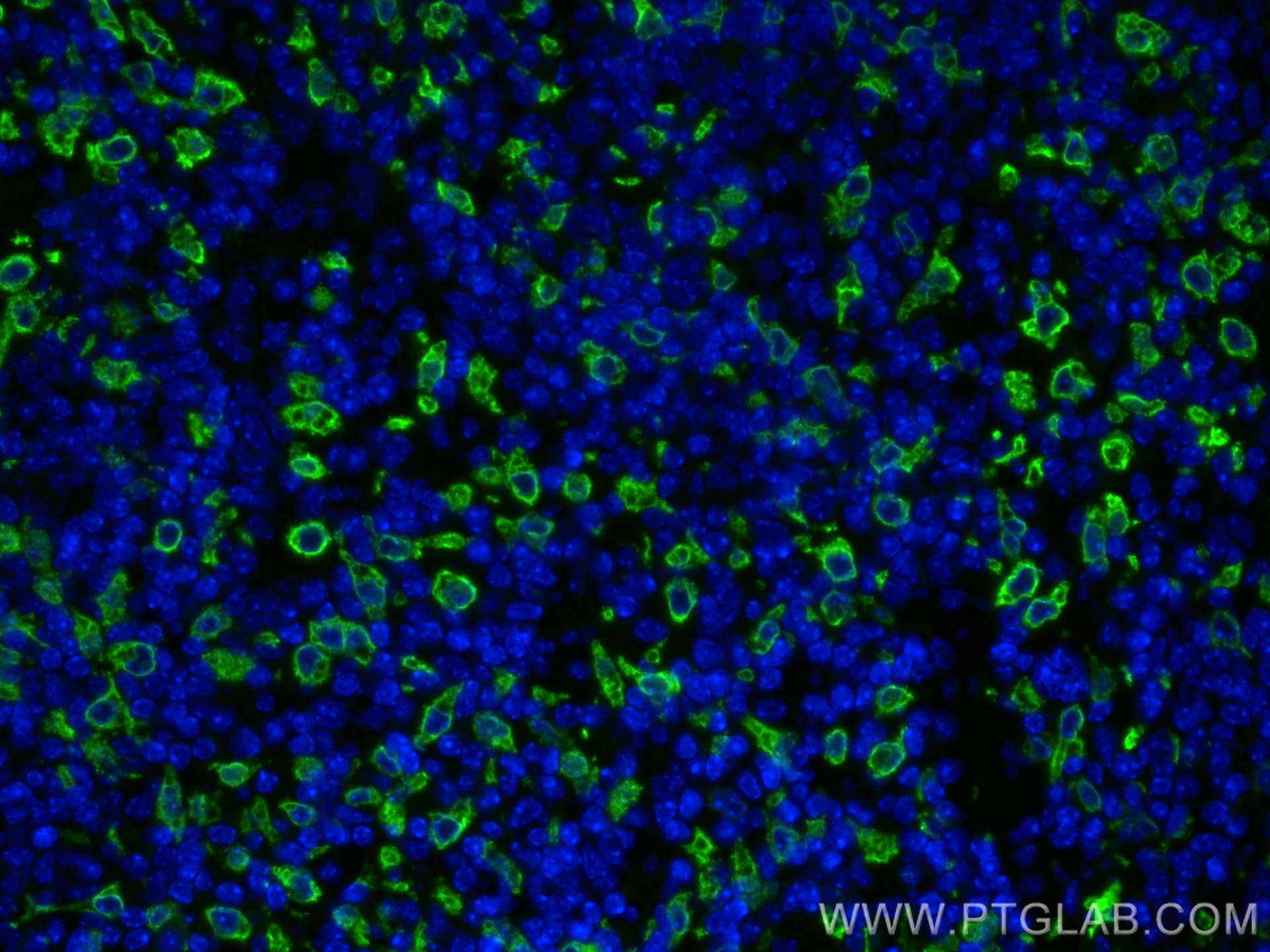 Immunofluorescence (IF) / fluorescent staining of mouse spleen tissue using HO-1/HMOX1 Polyclonal antibody (10701-1-AP)