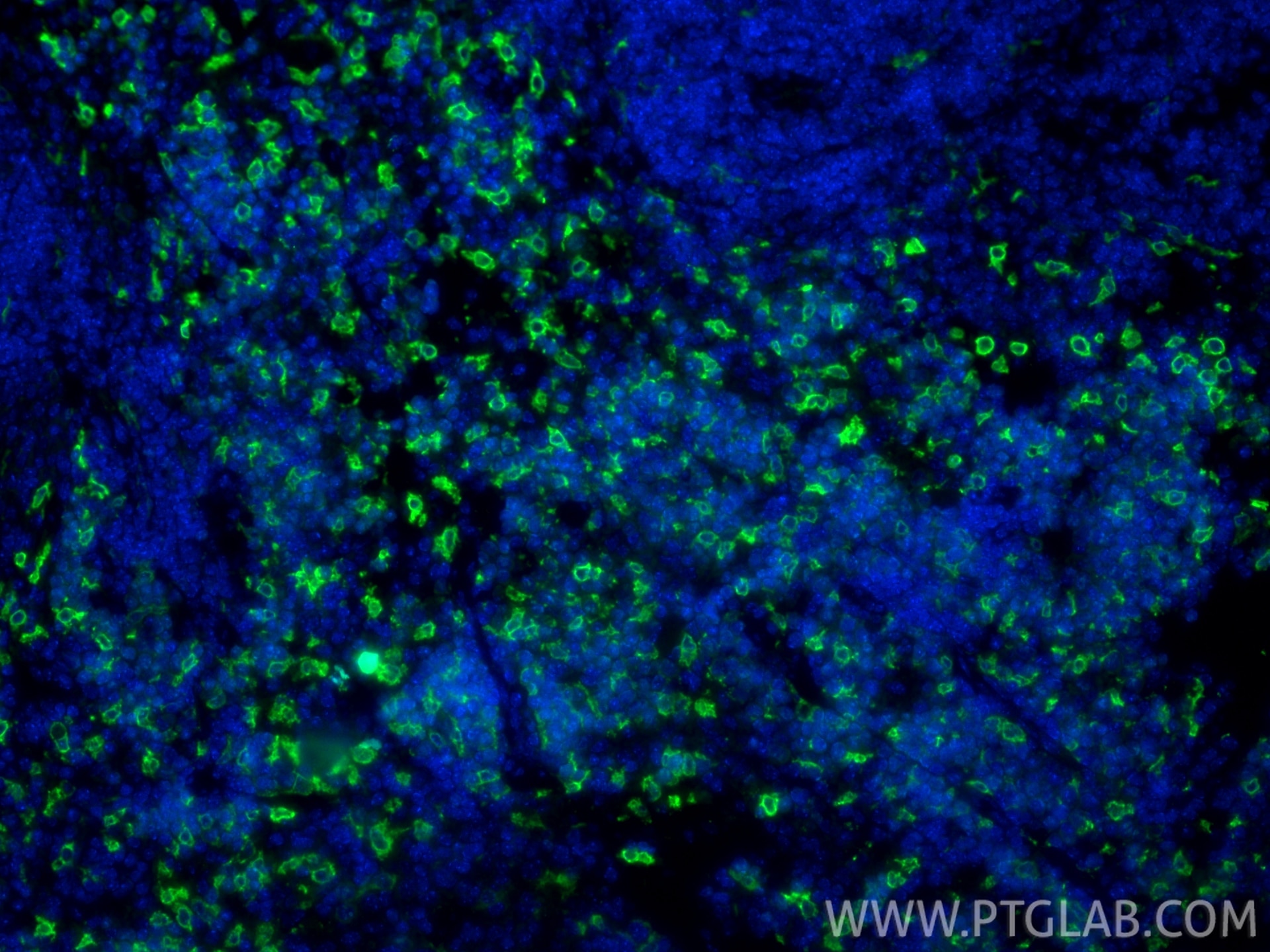 Immunofluorescence (IF) / fluorescent staining of mouse spleen tissue using HO-1/HMOX1 Polyclonal antibody (10701-1-AP)