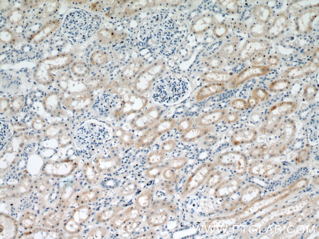 Immunohistochemistry (IHC) staining of human kidney tissue using HO-1/HMOX1 Polyclonal antibody (10701-1-AP)