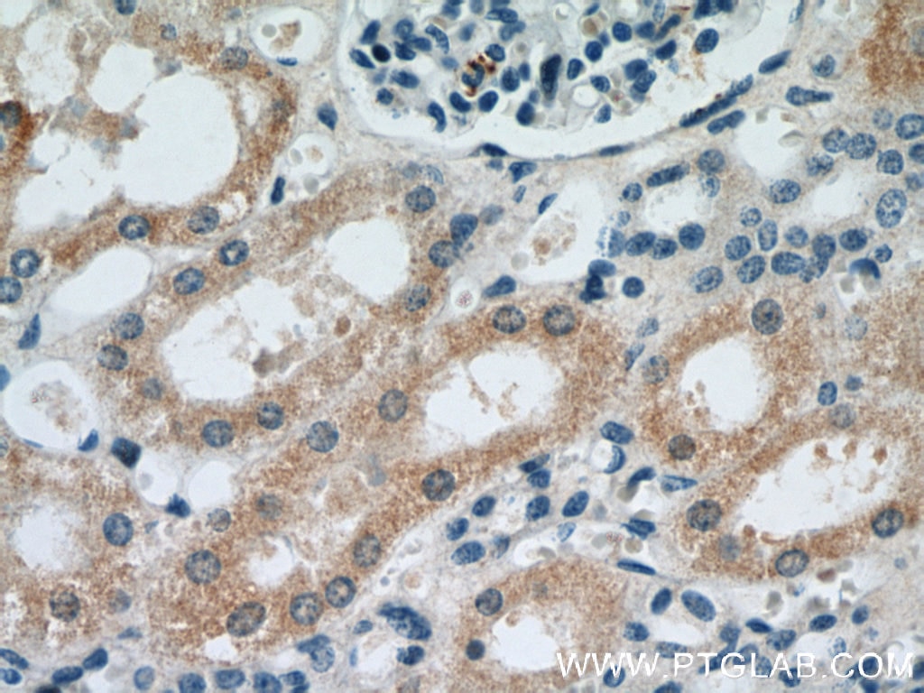 Immunohistochemistry (IHC) staining of human kidney tissue using HO-1/HMOX1 Polyclonal antibody (10701-1-AP)