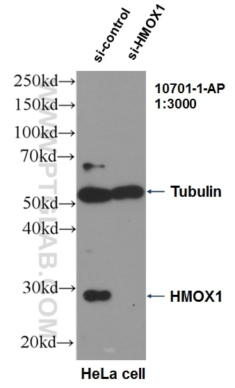 Western Blot (WB) analysis of HeLa cells using HO-1/HMOX1 Polyclonal antibody (10701-1-AP)