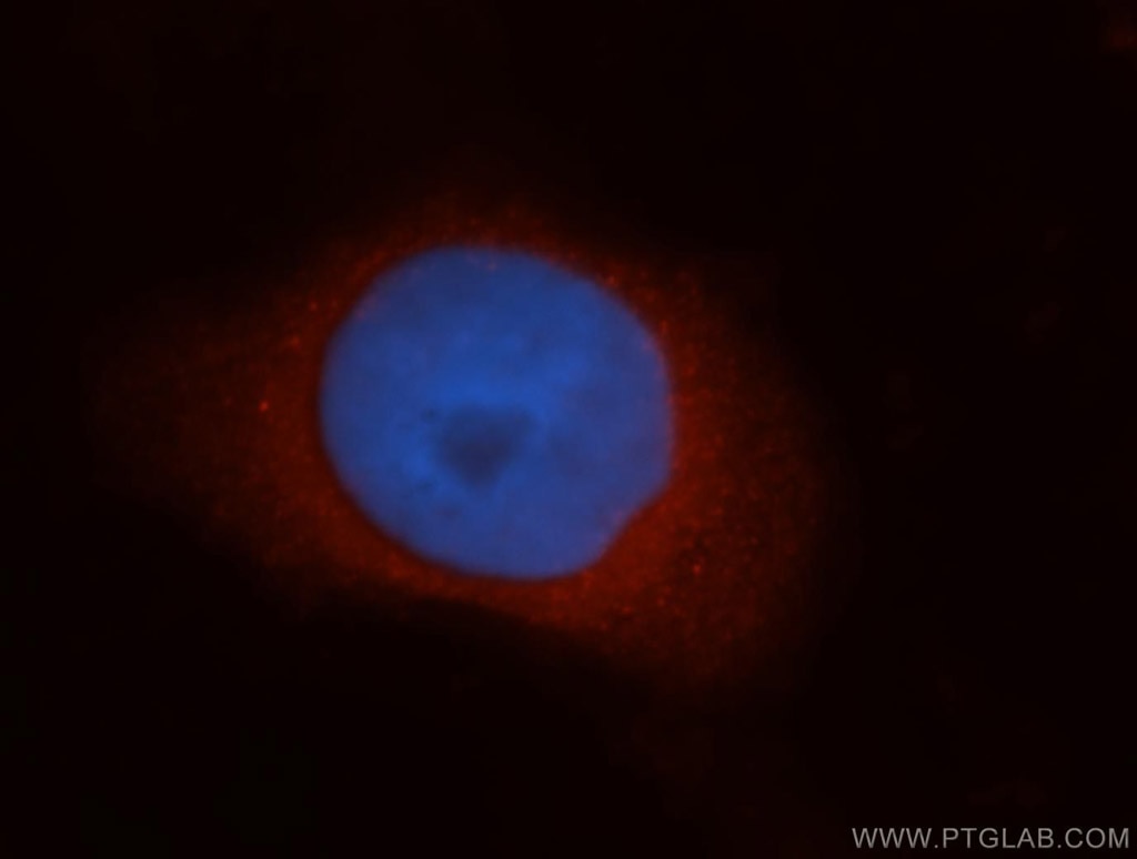 Immunofluorescence (IF) / fluorescent staining of HeLa cells using HMOX2 Polyclonal antibody (14817-1-AP)