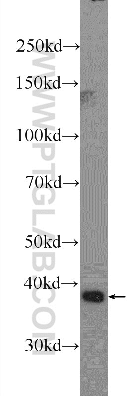 WB analysis of HepG2 using 14817-1-AP