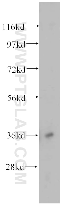 Western Blot (WB) analysis of Raji cells using HMOX2 Polyclonal antibody (14817-1-AP)