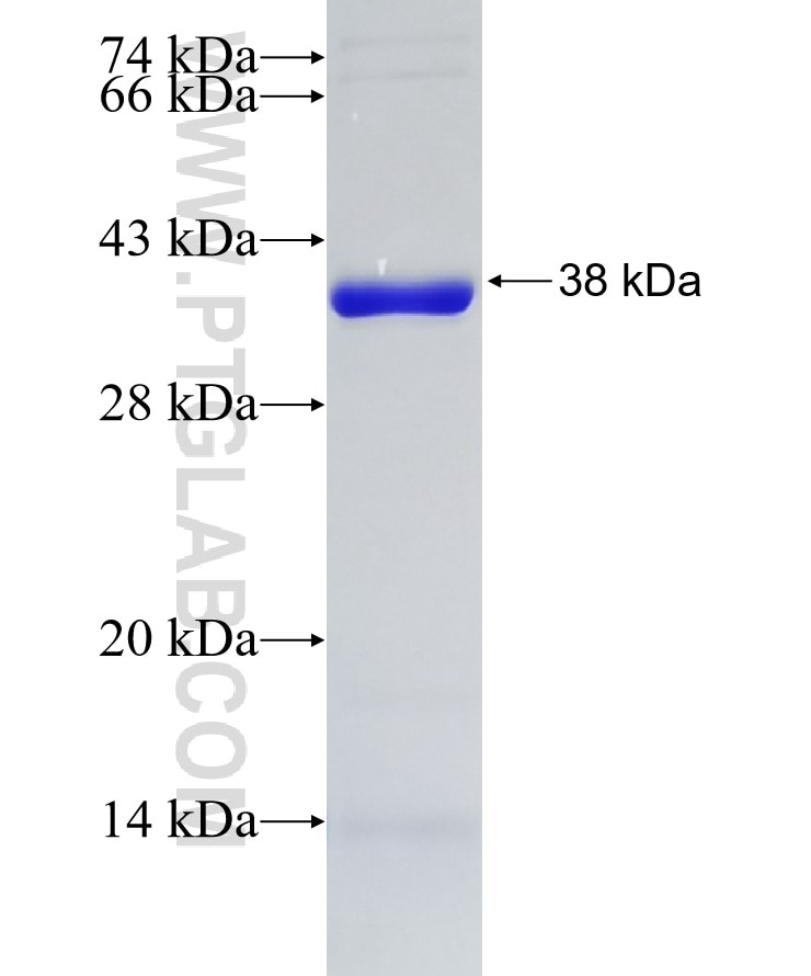 HMOX2 fusion protein Ag6575 SDS-PAGE