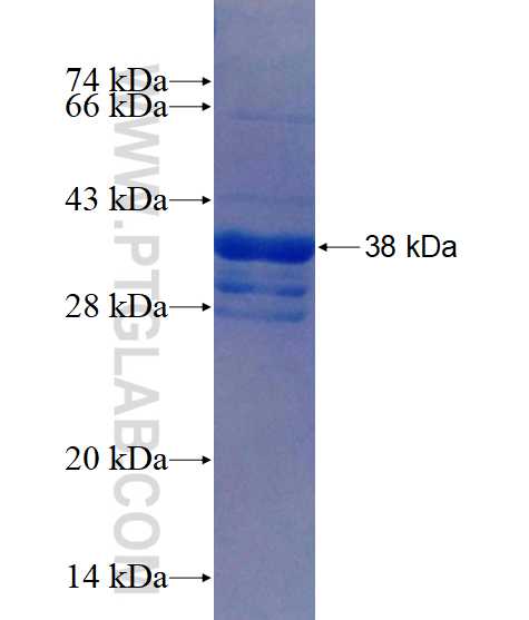 HMP19 fusion protein Ag13751 SDS-PAGE